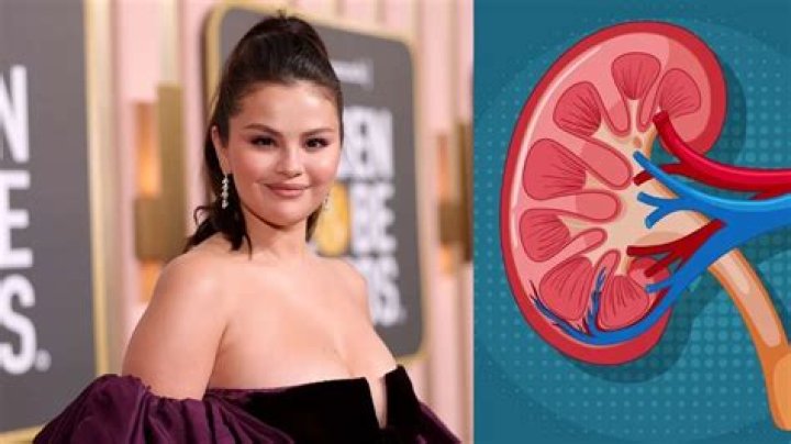Selena Gomez’s Kidney Transplant: Will She Need A Second In Her Lifetime? — Doctor Speaks